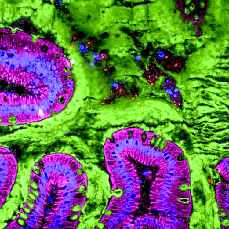 Un additif alimentaire couramment utilisé altèrerait le microbiote et l'environnement intestinal humain 